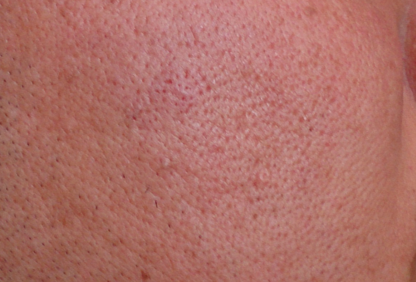 XeBbNRV[[/At^[